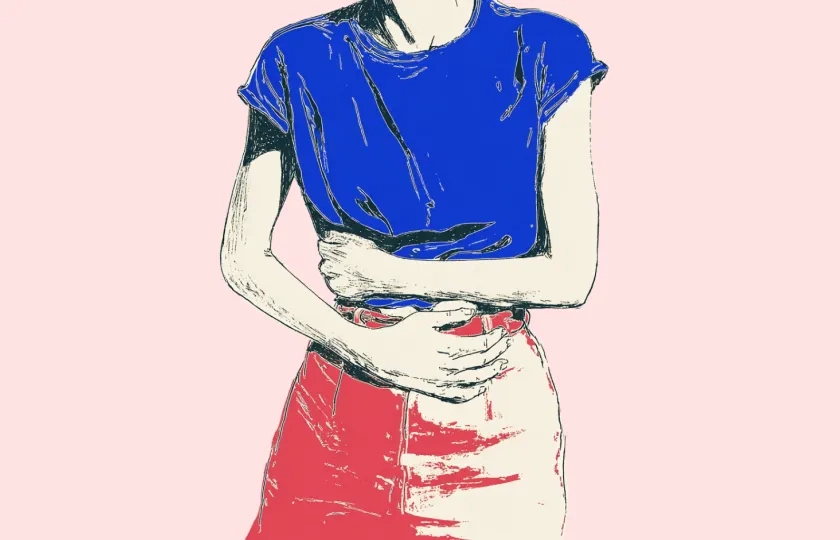 Illustrasjon endometriose